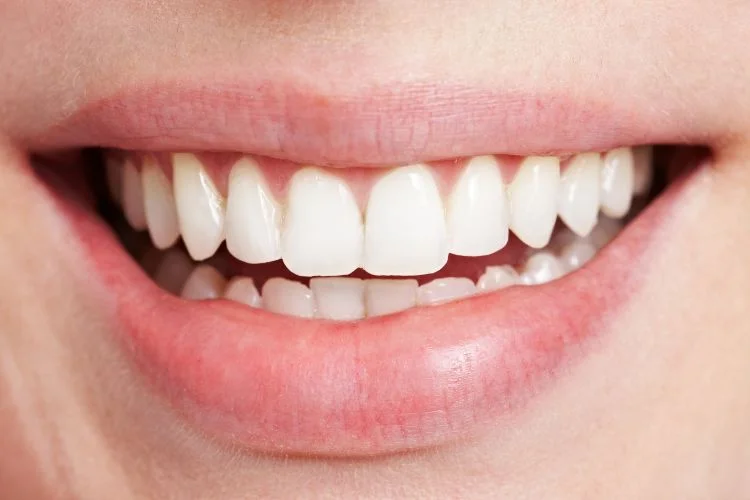 Un sourire éclatant d'une femme blanche.